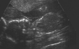 'The Fetus' Dean Malenko